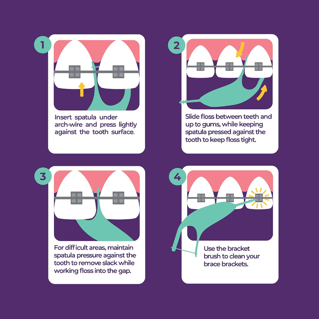 Four numbered steps showing the spatula going under the arch-wire and the floss worked to the gums