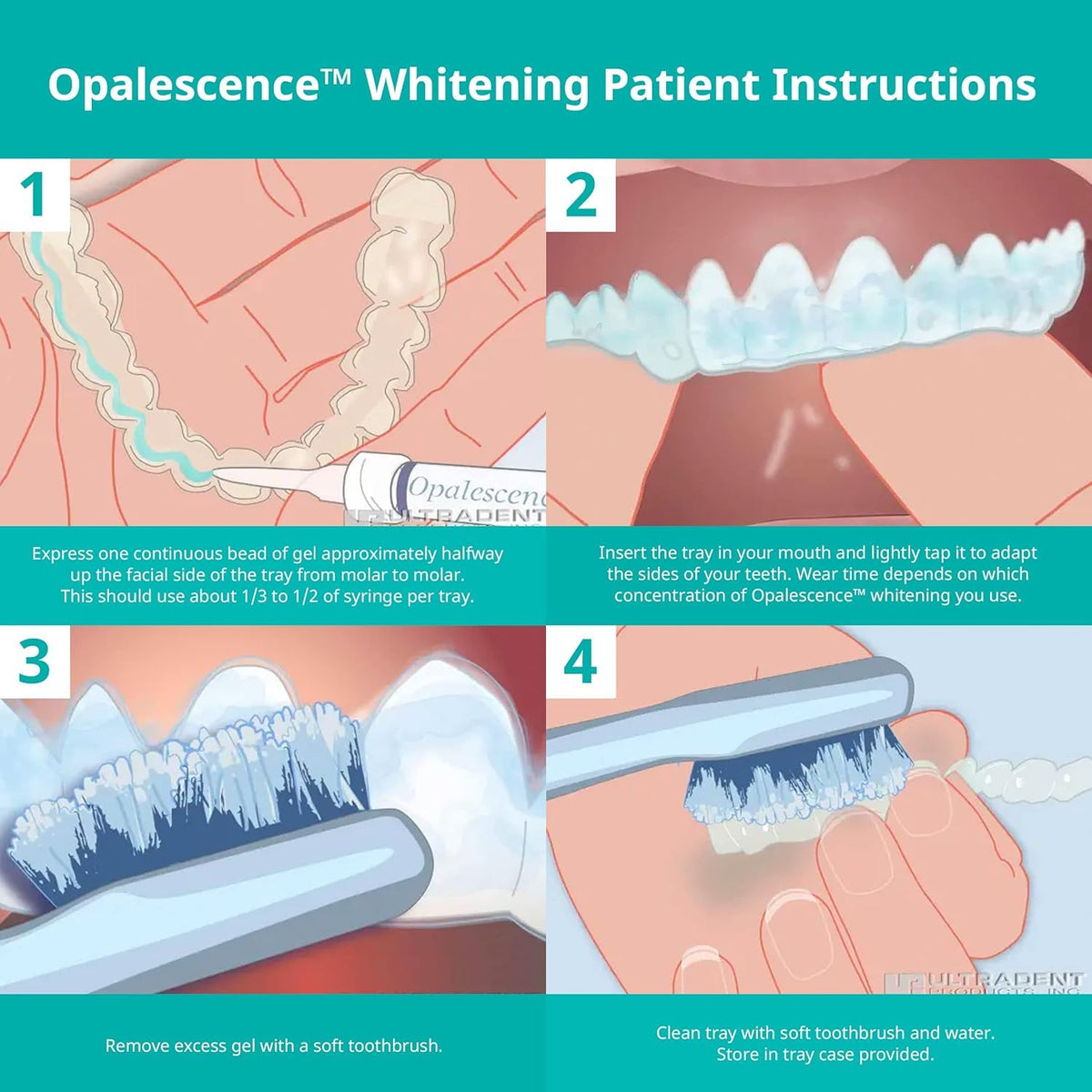 Opalescence Gel Syringes Teeth Whitening - Refill Syringe Kit Carbamide Peroxide | Mint Flavor 35%