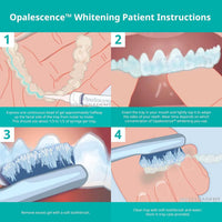 Opalescence Gel Syringes Teeth Whitening - Refill Syringe Kit Carbamide Peroxide | Mint Flavor 35%